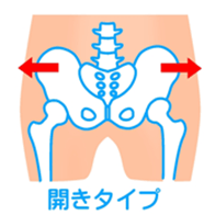 骨盤開きタイプ