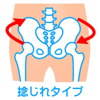 骨盤ねじれタイプ